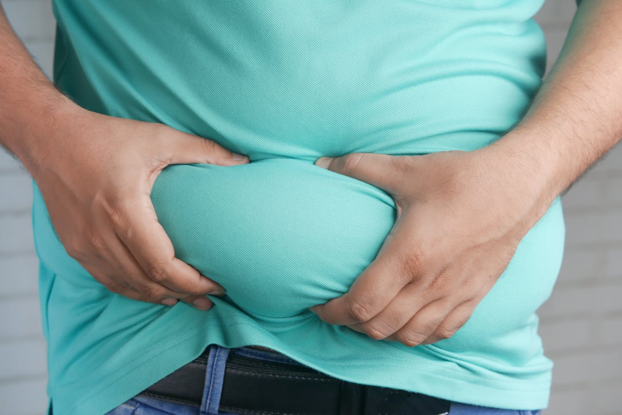 Weight Issues in  Miami, FL, .